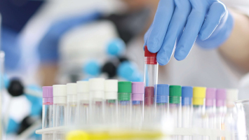 PBM voor laboratoria