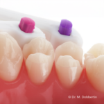 NASTRO A MATRICE SAFEMATRIX® CLEAR CONTOUR